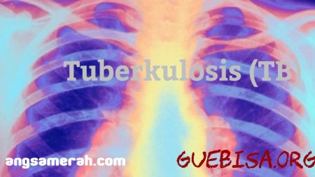 Tuberkulosis (TB)